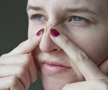 5 skutecznych metod na pozbycie się białych zaskórników z twarzy