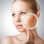 5 sposobów jak zapobiec przesuszaniu się skóry