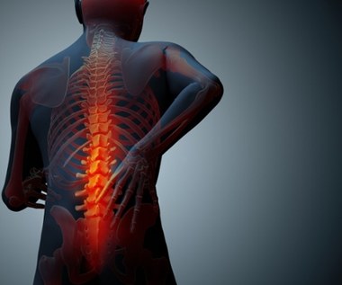 6 domowych sposobów na osteofity kości