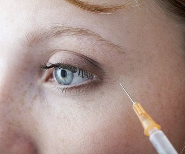 6 naturalnych sposobów na kurze łapki