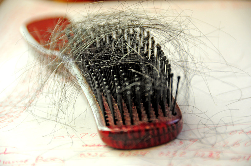7 naturalnych sposobów, aby zatrzymać wypadanie włosów /© Photogenica