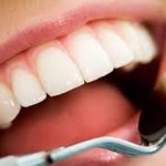 7 problemów zdrowotnych, o których informuje nas stan jamy ustnej