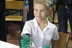 8-latek dostał protezę ręki - wydrukowaną techniką druku trójwymiarowego