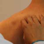 800 tys. zł za błąd medyczny. Powód? Lekarze zlekceważyli pieprzyk