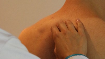 800 tys. zł za błąd medyczny. Powód? Lekarze zlekceważyli pieprzyk