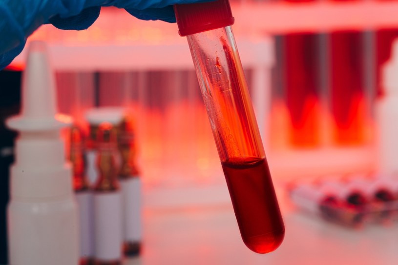 Aby potwierdzić hemofilię, konieczne są badania krwi oceniające funkcjonowanie układu krzepnięcia /123RF/PICSEL
