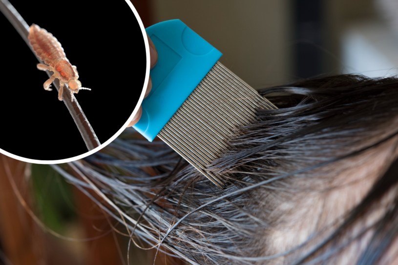 Aby skutecznie pozbyć się wszy, włosy należy starannie wyczesywać grzebieniem o wąsko rozstawionych ząbkach, by pozbyć się gnid /123RF/PICSEL