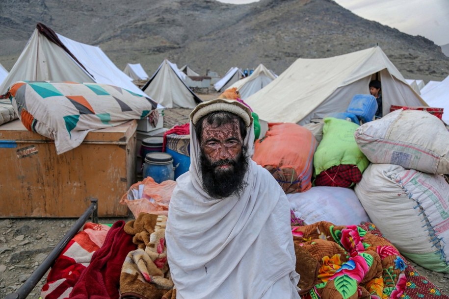 Afgański uchodźca na granicy afgańsko-pakistańskiej w Torkham /SAMIULLAH POPAL /PAP/EPA