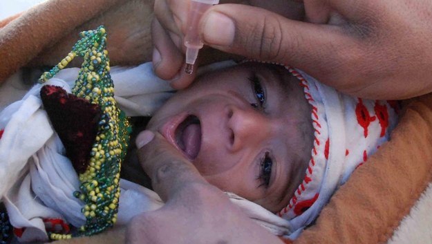 Afgańskie dziecko chore na polio /AKHTER GULFAM /PAP/EPA