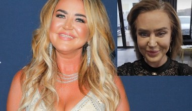 Agnieszka Kotońska pokazała, jak wygląda bez doczepów. Widok wprawia w osłupienie