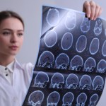 AI fałszuje zdjęcia RTG. Nawet radiolodzy dają się nabrać