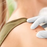 AI identyfikuje wczesne wzorce ryzyka. Idzie nowe w diagnozie czerniaka