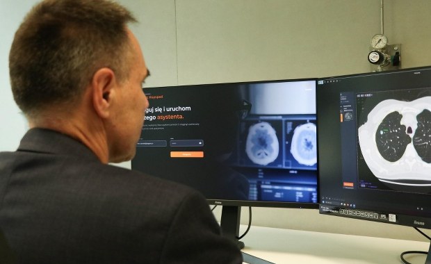 AI kontra choroby. Technologia z AGH zmienia diagnostykę