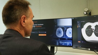 AI kontra choroby. Technologia z AGH zmienia diagnostykę