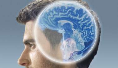 AI niczego nie przeoczy. Zobaczy to, czego nie zauważył lekarz