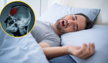 AI wykrywa choroby na podstawie analizy snu. Niezwykła trafność diagnozy