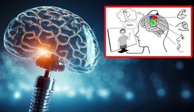 AI zmienia myśli w mowę i gesty. Pierwszy taki implant mózgowy na świecie