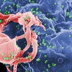 AIDS w trzy lata - nowa, wyjątkowo agresywna odmiana wirusa HIV