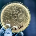 Alarmujące dane: Oporne na antybiotyki bakterie w Europie