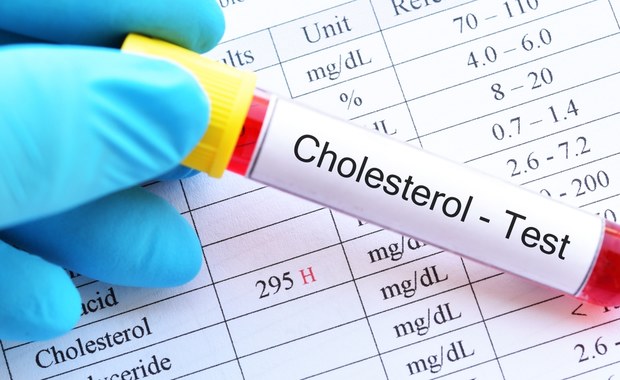 Alarmujące dane. Ponad połowa dorosłych ma problem z cholesterolem 