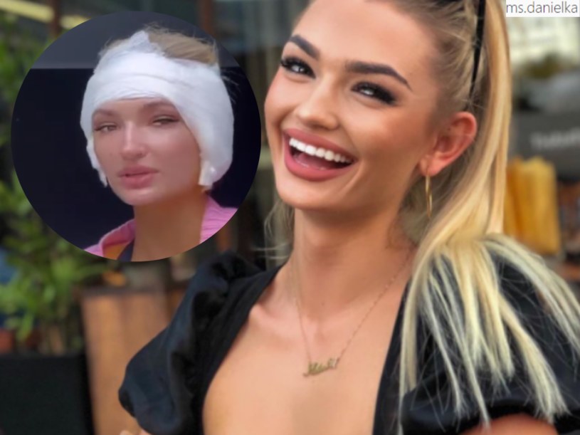 Aleksandra Daniel na IG pochwaliła się, że przeszła operacje @ms.danielka/ /Instagram