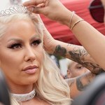 Amber Rose poddała się kolejnym zabiegom upiększającym