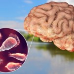 Ameba "zjadła" mu mózg. Płukał nos nieprzegotowaną wodą