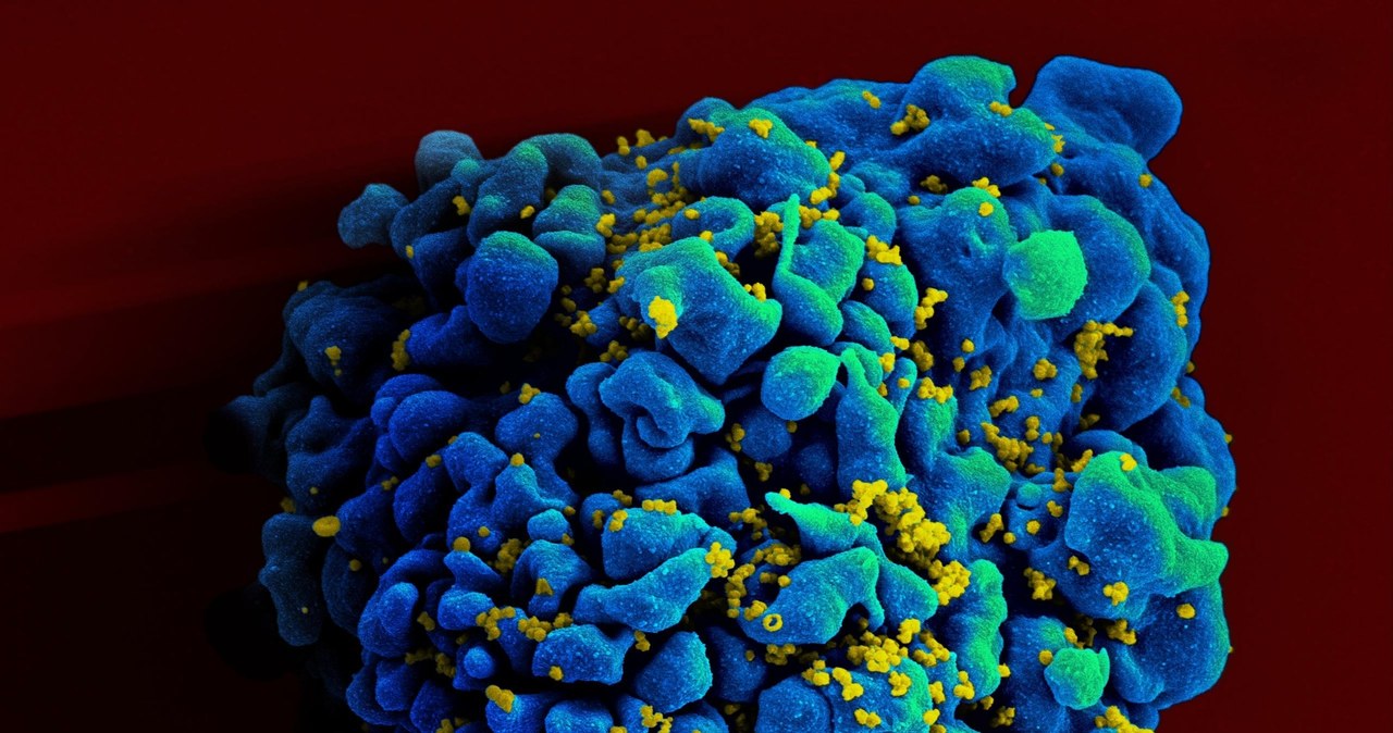 Amerykanka została wyleczona z HIV dzięki przeszczepowi komórek macierzystych /Getty Images