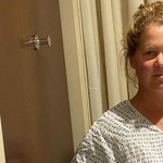 Amy Schumer usunęła macicę. Walczy z podstępną chorobą