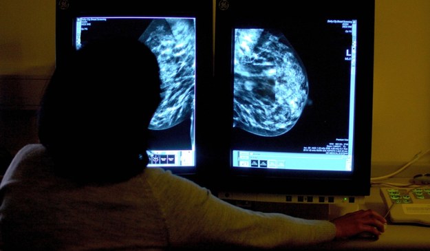 Analiza badania mammografem (zdjęcie ilustracyjne) /Rui Vieira    /PAP/EPA
