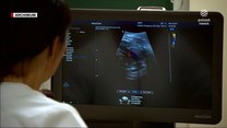 "Wydarzenia": Badanie serca, które ma 20mm. Nowy sprzęt dla Centrum Zdrowia Matki Polki