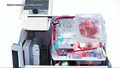 "Wydarzenia": Kardiochirurdzy zbierają pieniądze na maszynę do transportu serca