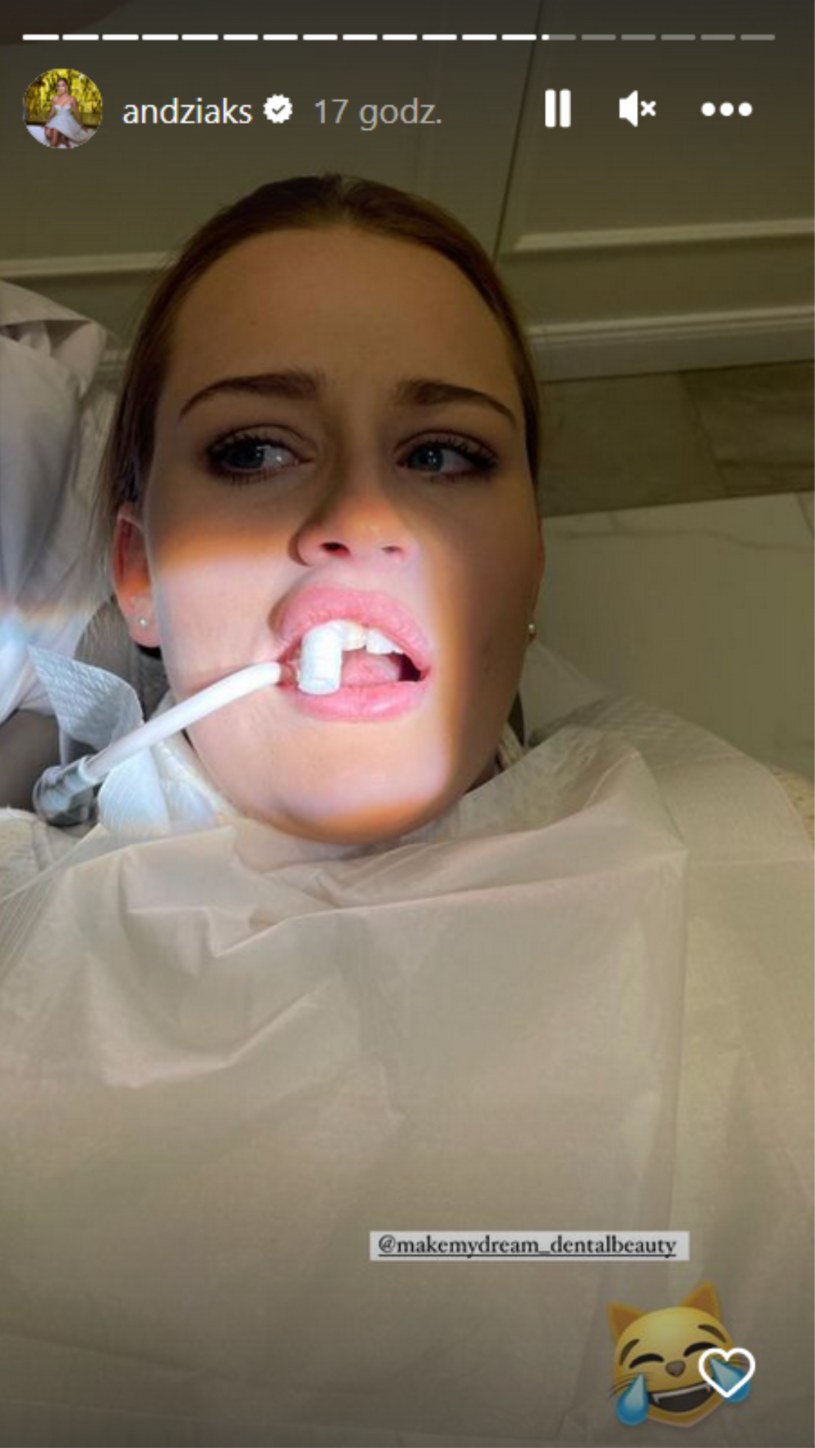 Andziaks straciła ząb. Swój "dramat" Youtuberka pokazała w sieci @andziaks/ /Instagram