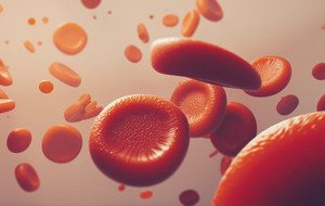 Anemia - jakie wyniki badań na nią wskazują? Czy anemia wyjdzie w badaniu krwi?