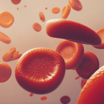 Anemia - jakie wyniki badań na nią wskazują? Czy anemia wyjdzie w badaniu krwi?