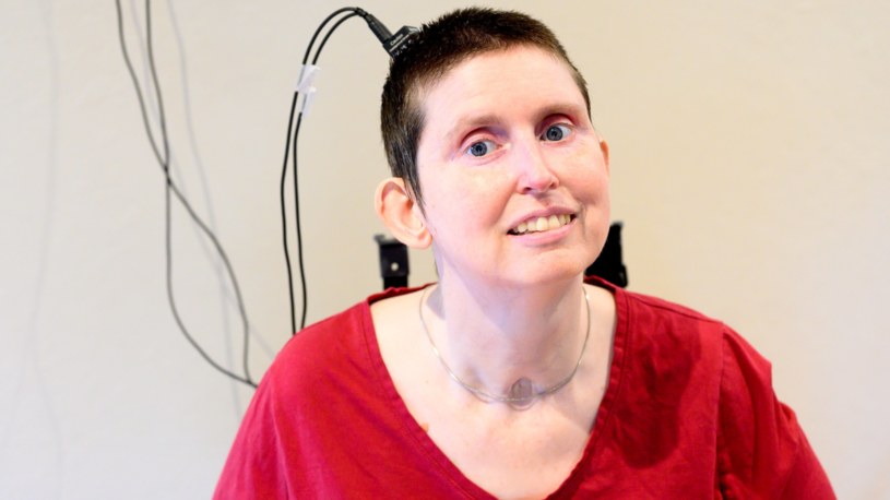 Ann odzyskała głos po 18 latach. Pomógł specjalny implant mózgu /@UCSF /Twitter