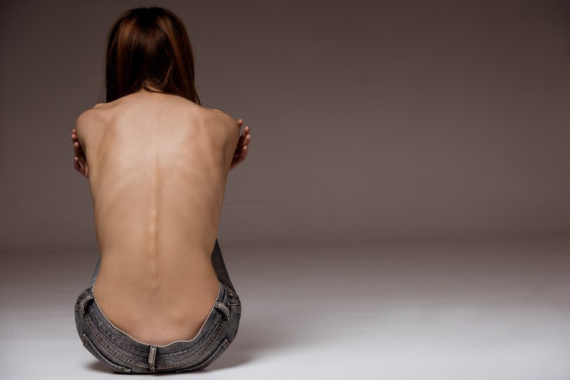 Anoreksja znacznie częściej dotyczy kobiet, ale mężczyźni też cierpią na zaburzenia odżywiania /123RF/PICSEL