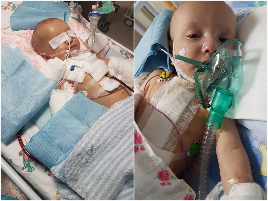 Antoś pilnie potrzebuje kosztownej operacji serca /Archiwum prywatne /