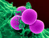 Antybiotyki mogą wspomagać bakterie