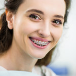 Aparat ortodontyczny - sposób na piękny uśmiech! Jakie są wady i zalety noszenia aparatu na zęby?