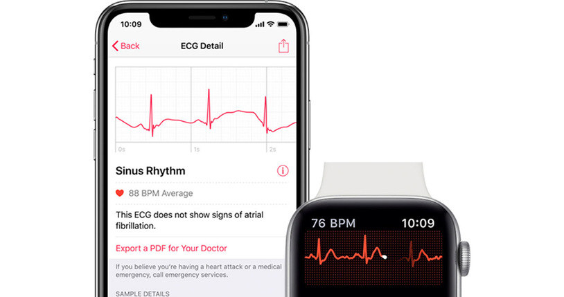 Apple Watch i funkcja EKG /materiały prasowe
