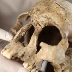 Archeolodzy znaleźli stożkowate czaszki. Zobacz głowę "kosmity"