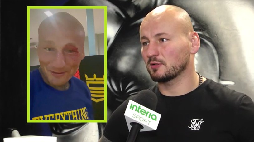 Artur Szpilka zakrwawiony na treningu: Niech trener zobaczy!