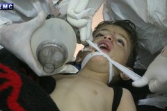 Atak chemiczny w Syrii. Wśród kilkudziesięciu ofiar są dzieci