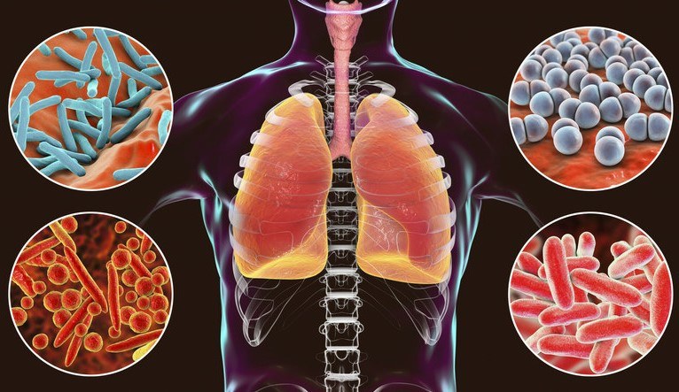 Atypowe zapalenie płuc może dać ciężkie powikłania w postaci zapalenia mięśnia sercowego, zapalenia mózgu czy niewydolności nerek /123RF/PICSEL