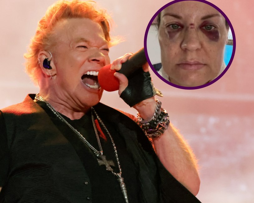 Axel Rose z Guns N' Roses rzucił mikrofonem w fankę /Amy Sussman /Getty Images