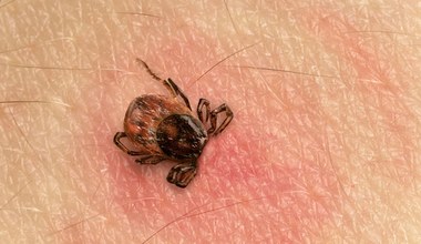 Babeszjoza - choroba o wielu twarzach. Co ma wspólnego z malarią?