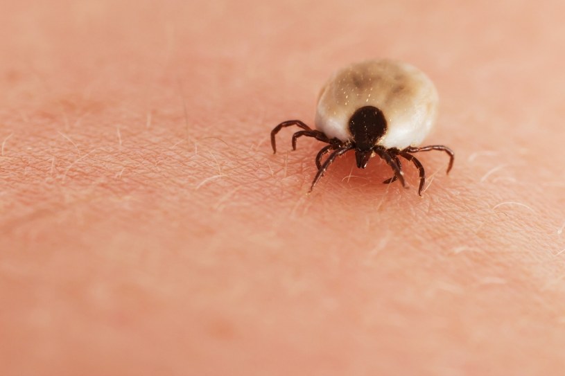 Choroba Przenoszona Przez Komary Krzyżówka Babeszjoza - przyczyny, objawy, leczenie - Zdrowie w INTERIA.PL