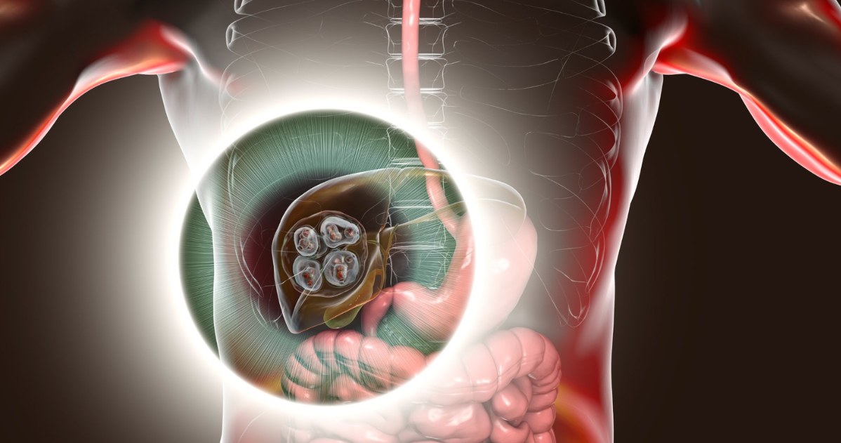 Bąblowica wielokomorowa docelowo trafia do wątroby i tam tworzy torbiele, zawierające tasiemca /123RF/PICSEL