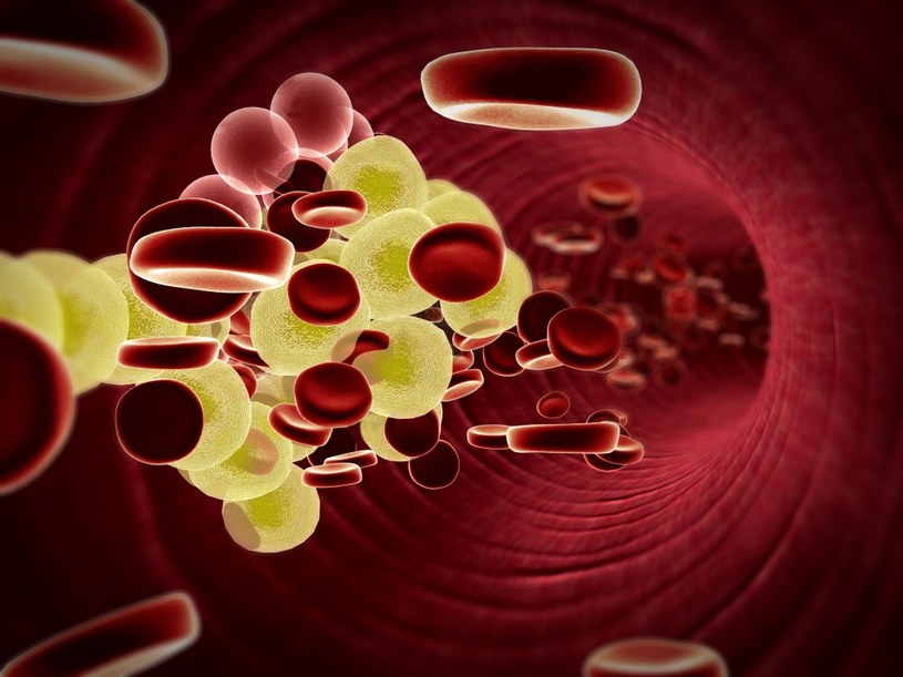 Badaj regularnie poziom cholesterolu (LDL) /123RF/PICSEL